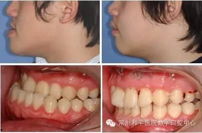 成人眼神矫正方法视频,成人眼神矫正方法视频解析