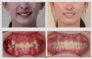 成人眼神矫正方法视频,成人眼神矫正方法视频解析