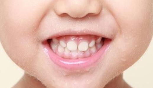 成人乳牙根处理方法视频,成人乳牙根处理技巧解析