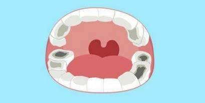 成人长蛀牙视频播放,视频解析蛀牙成因及预防措施