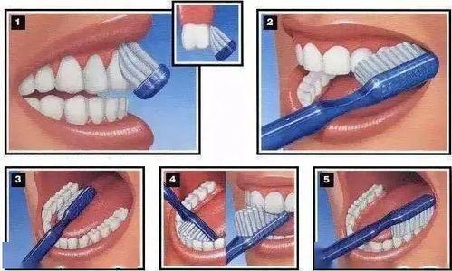 成人长蛀牙视频播放,视频解析蛀牙成因及预防措施